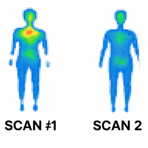 Diagnostic scan showing high-pressure zones on foam mattress
