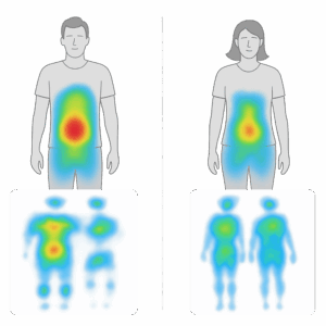 Pressure zones reveal mismatched lumbar and shoulder support on shared foam mattress